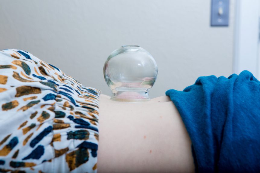 Acupuncture Beth Kearns Acupuncture